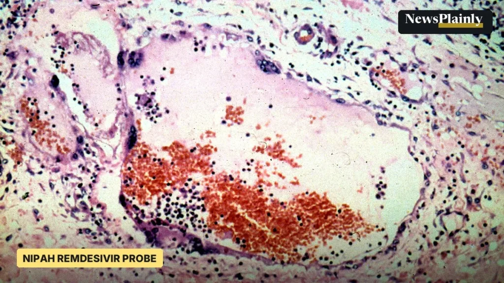 Microscope image of tissue infected by Nipah virus, CSIRO file image for Nipah remdesivir probe story